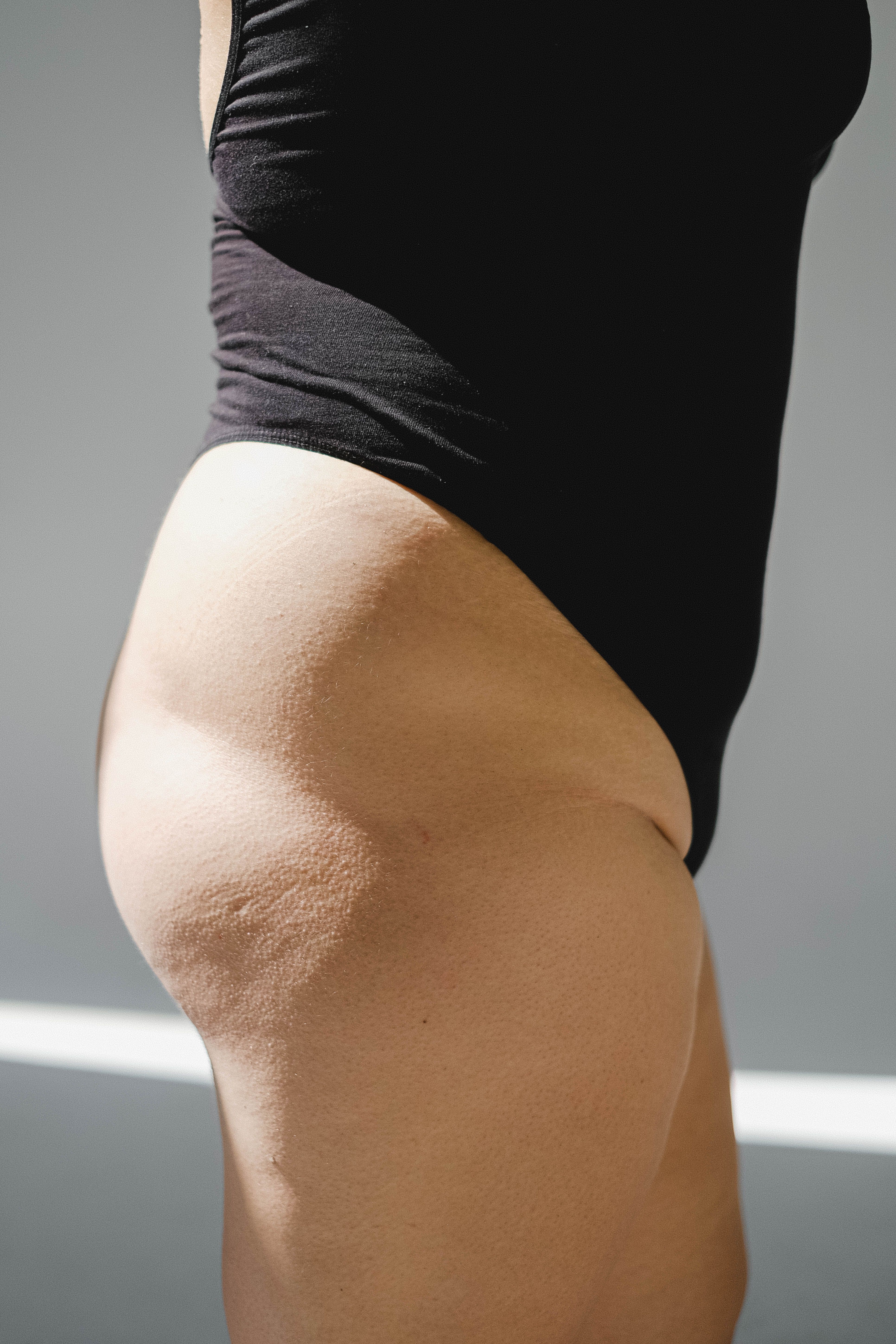 Hautbild nach der Behandlung bei Aida Beauty